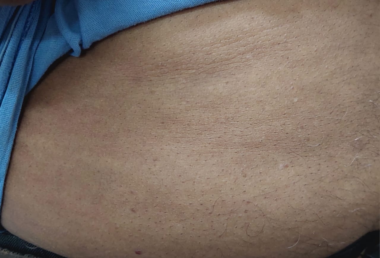 After treatment